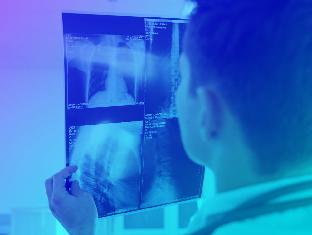 x-ray-pune